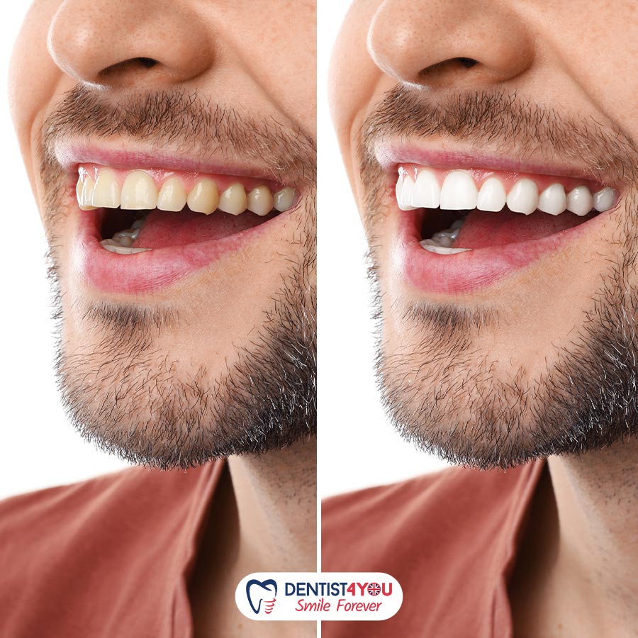 dental treatments in turkey